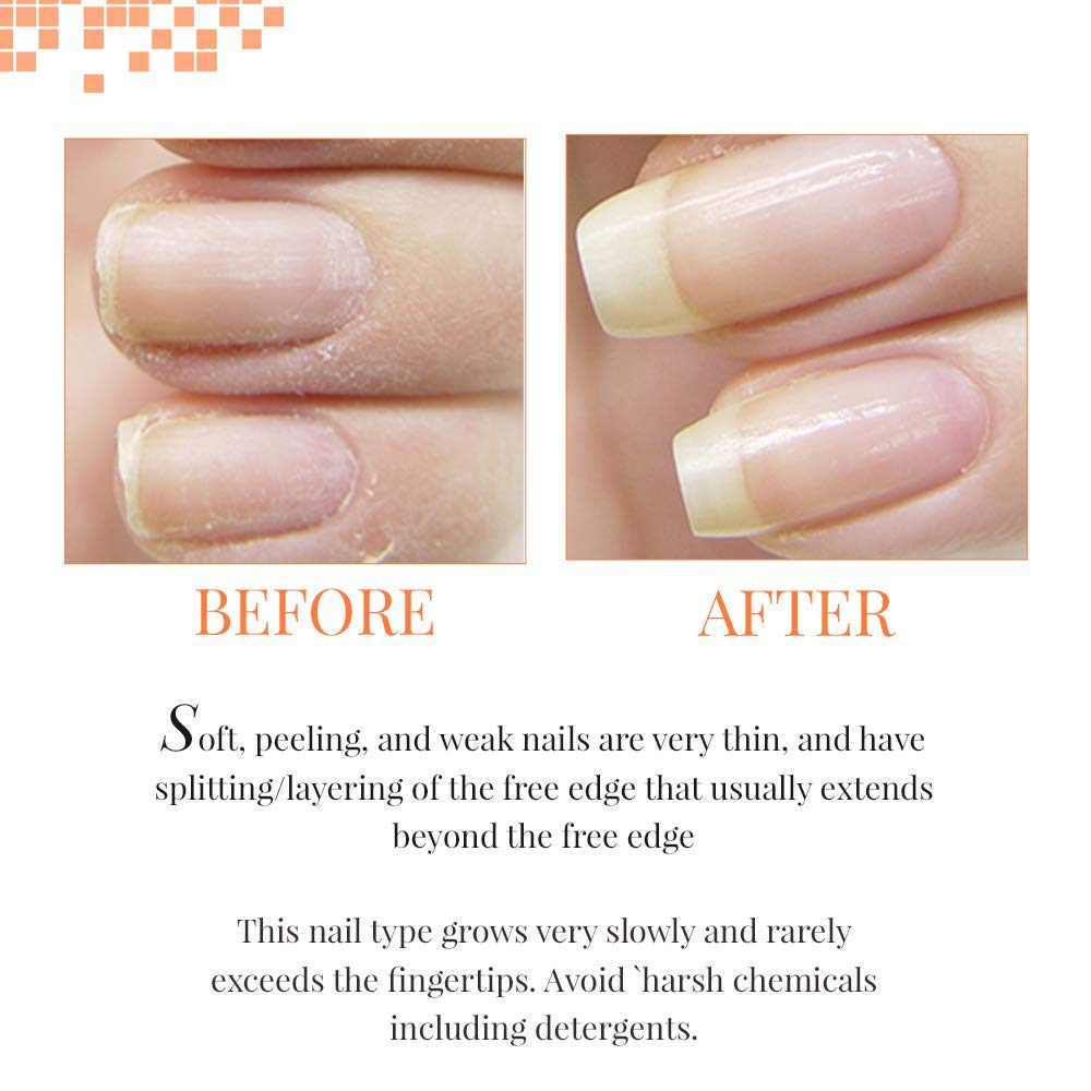NailTek Foundation II - .5 oz, 14.2 g (Pack of 1) - Image 4