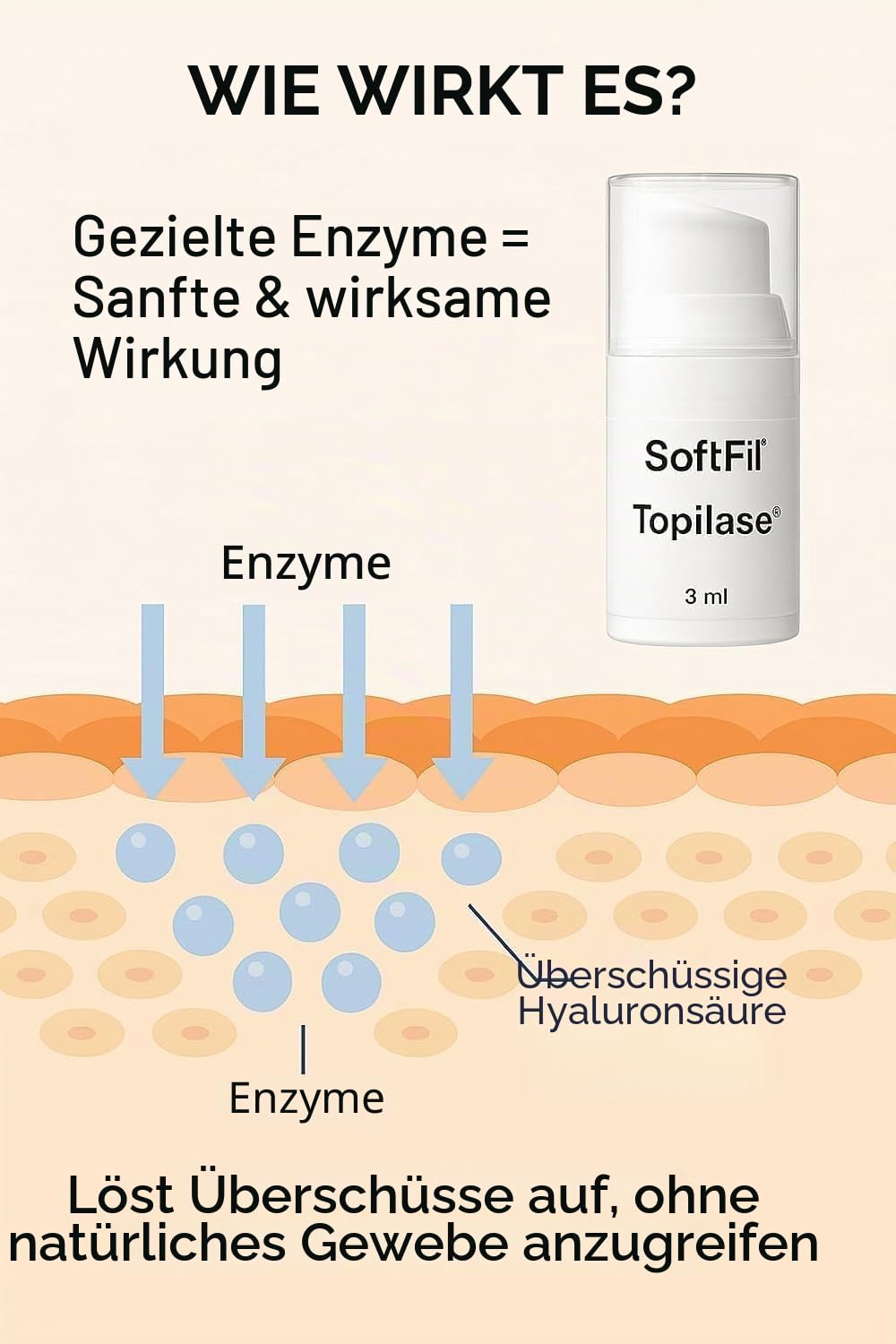 SoftFil Topilase – Hyaluronidase Gel zur Entfernung von Hyaluronsäure – Filler Entferner für Gesicht – Post-Injection Pflege – Korrektur nach ästhetischer Behandlung – Hautregeneration – 3 ml
