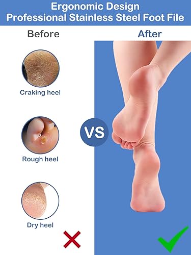 Miniatura 5 de Lima de pie profesional para pies, rallador de talón, rallador de piel muerta dura, callos y pedicura, lima de pies y 5 limas de pedicura