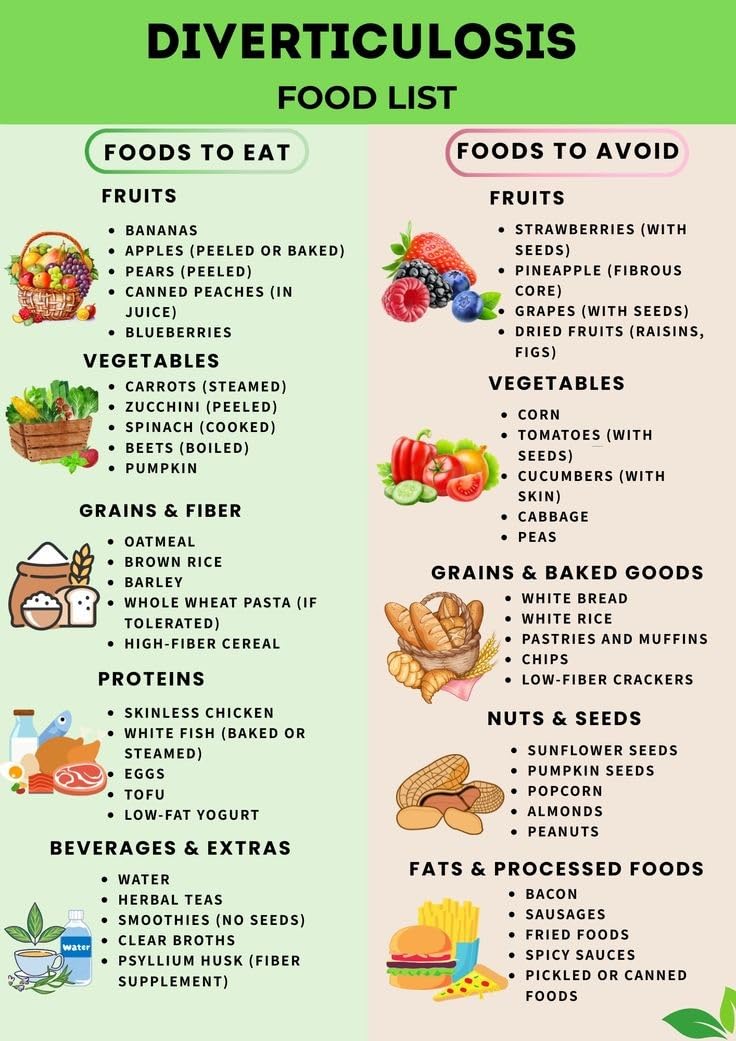 ZNRNVYIEN Diverticulosis Food List Printable - High Fiber Chart for Colon Health, Diverticulitis Diet Guide, Eat and Avoid Foods Poster Unframed,08x12inch(20x30cm)