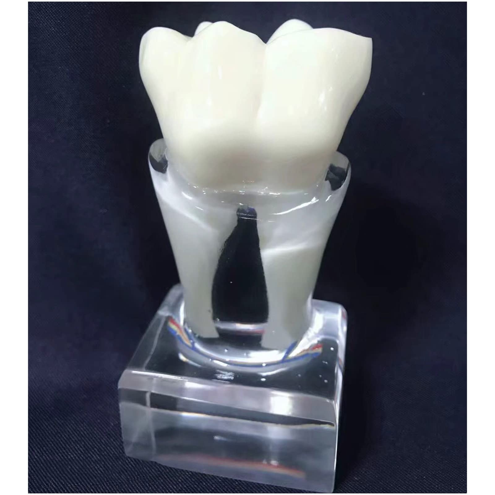 6 modèles de profil dentaire – Modèle d'étude – Modèle d'affichage dentaire – Modèle anatomique des dents – Instrument d'enseignement clair – Pour communication médecin-patient