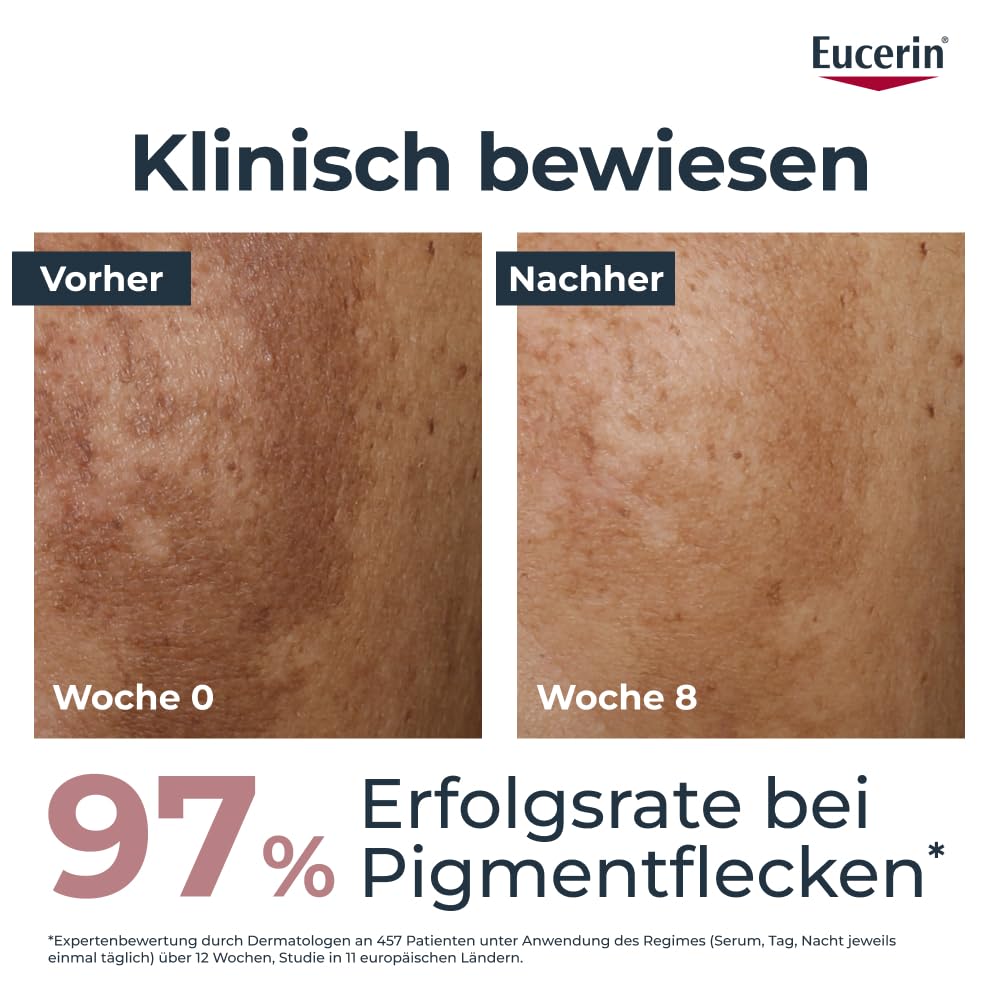 Eucerin Anti-Pigment Dual Serum 30 ml, Gesichtsserum | Reduziert sichtbar Pigmentflecken, Verleiht einen gleichmäßigen Hautton, Mit Thiamidol & Hyaluronsäure