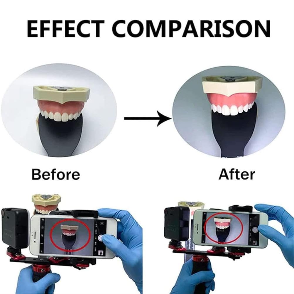 Dental-Fotografiehilfe mit LED-Fülllicht für orale Handy-Kamera, verbessert Foto- und Videoqualität zu Hause, in der Klinik und im Krankenhaus