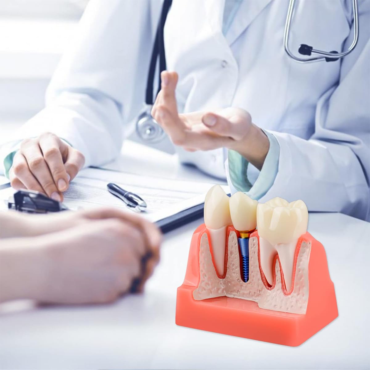 Sarini Modelo de Diente Oral, Modelo de implante Dental con Corona y Puente extraíbles para demostración y formación