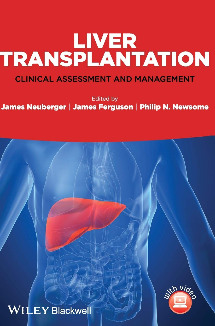Buy Liver Transplantation Clinical Assessment And Management — BookShops.in