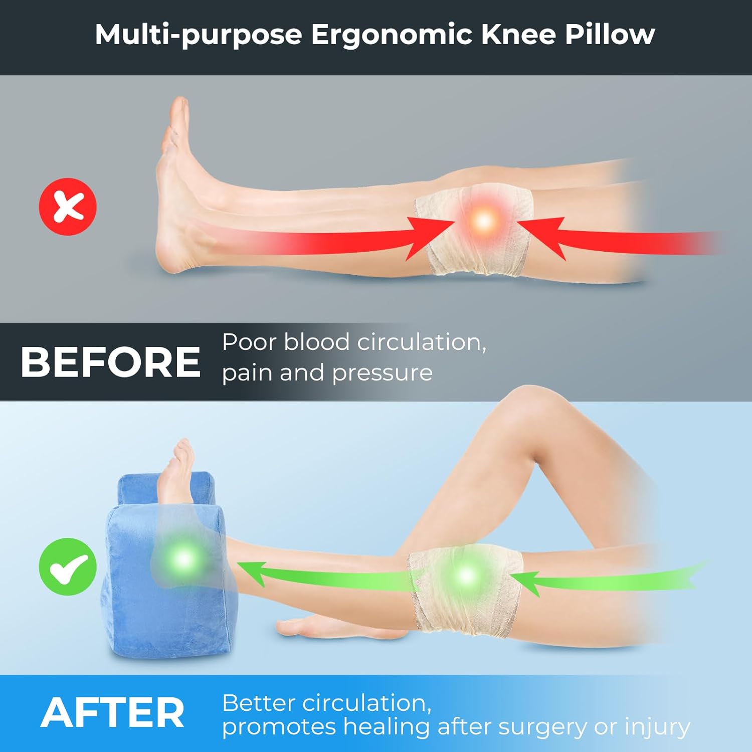 EKEPE Knee Replacement Surgery Pillow for Post Surgery Recovery - ACL Surgery, Knee Surgery and Hip Surgery Recovery, Portable Leg Elevation Pillow for Cotton Leg Support Pillow, Rehab, Extension