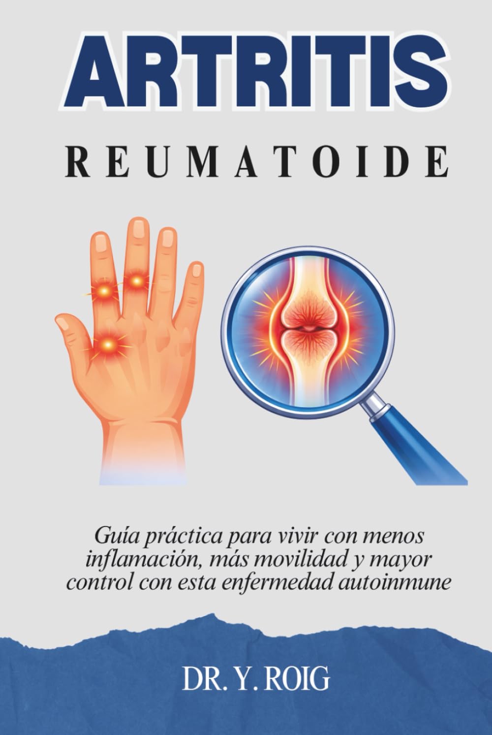 Artritis reumatoide: Guía práctica para vivir con menos inflamación, más movilidad y mayor control con esta enfermedad autoinmune