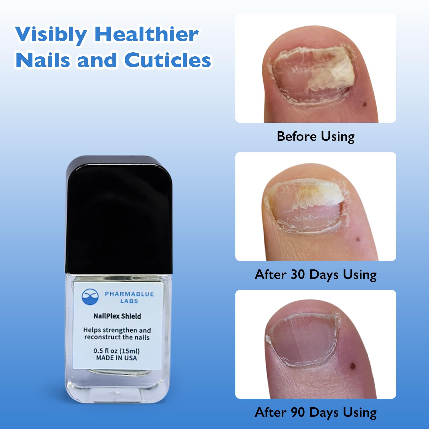 NailPlex Shield - Estirador de uñas para uñas dañadas, fórmula avanzada, tratamiento de suero para cutículas, 0.5 onzas líquidas 3