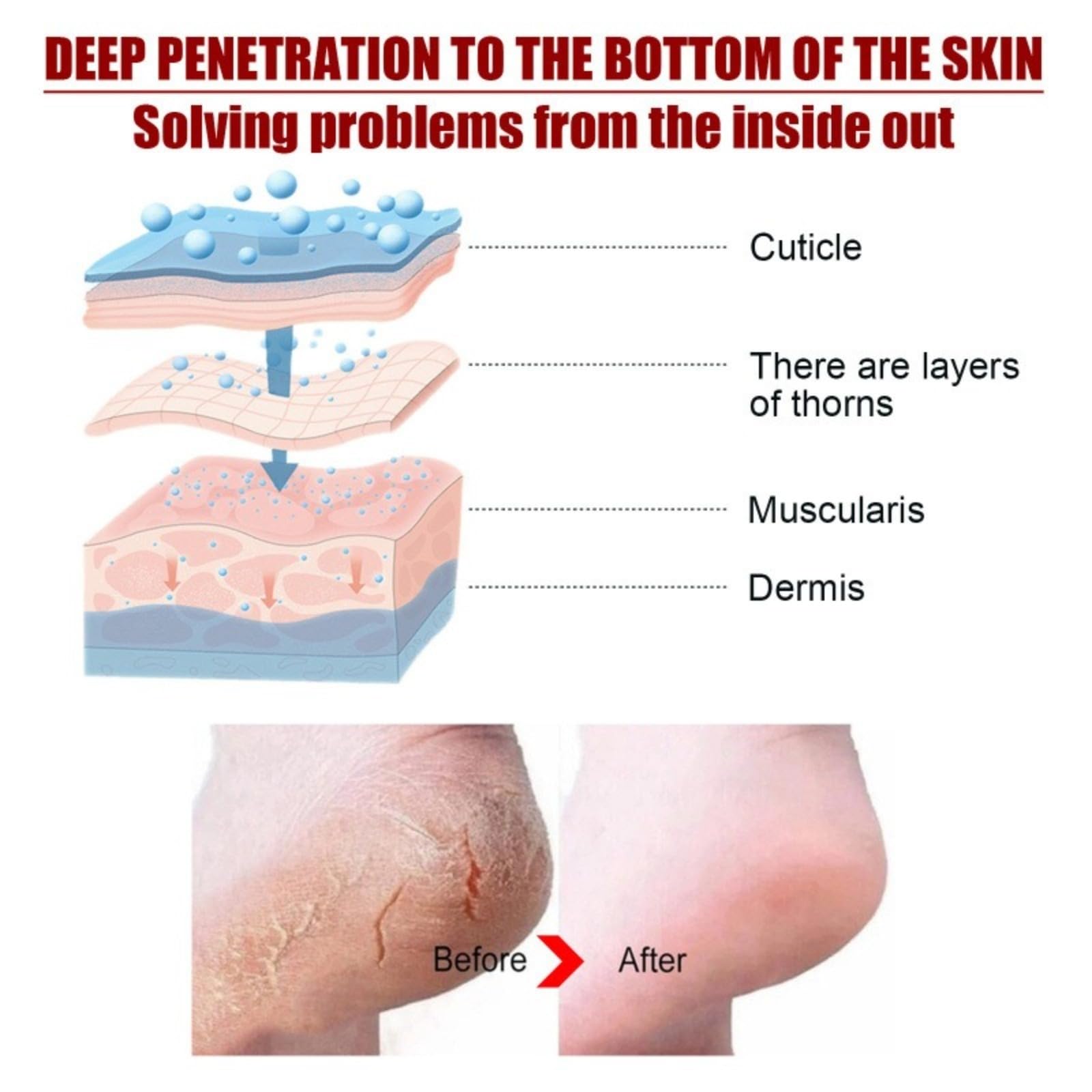 Máscara de pie para peeling de melocotón, máscara de pies hidratante con nueces de coco- Cuidado de callos y pieles muertas - Pie Hidratante, exfoliante, callo peeling pies