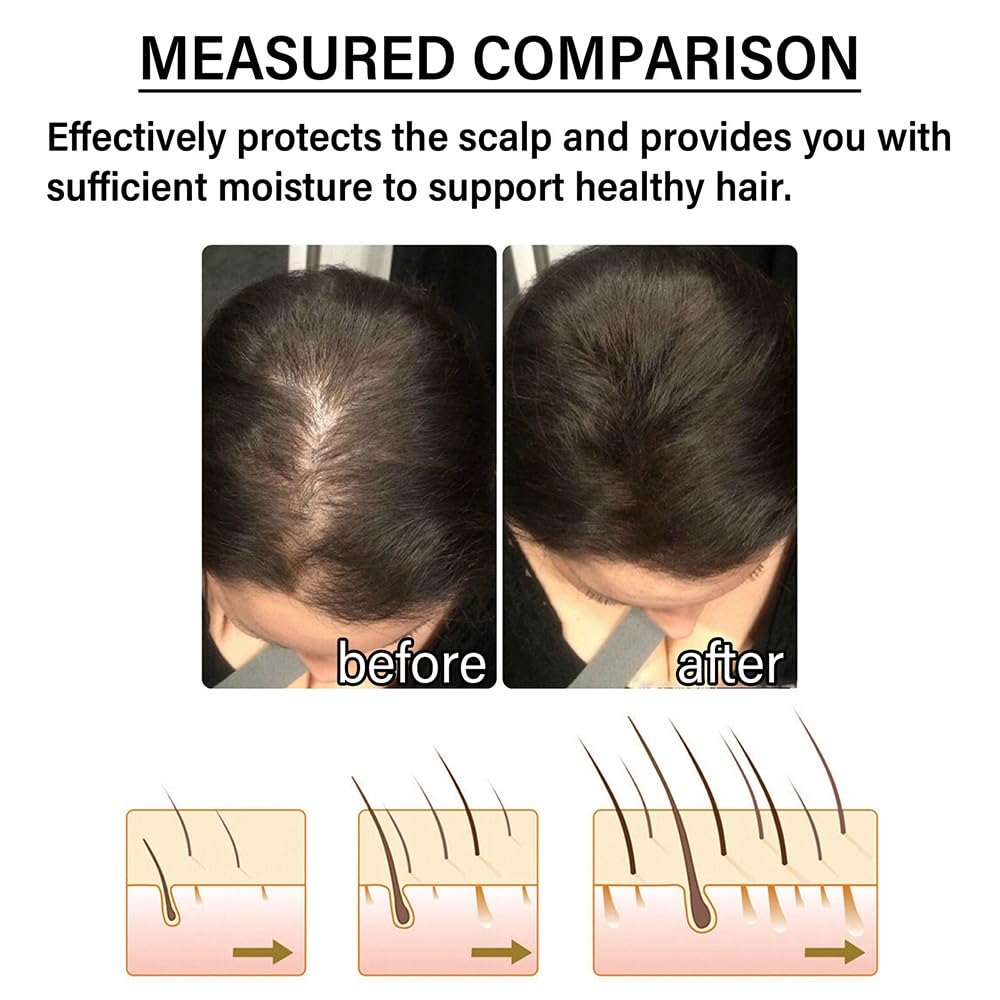 Custodia for shampoo for capelli alle erbe Polygonum allo zenzero, lavaggio nutriente delicato alla radice for capelli lisci e luminosi