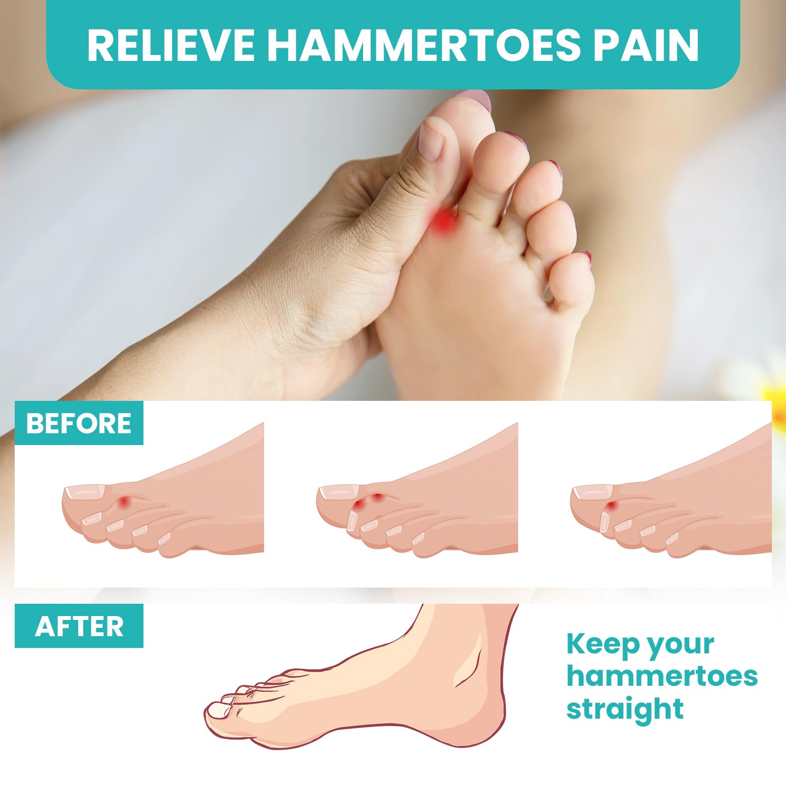 Promifun Separatori per dita dei piedi, 2 paia di distanziatori per dita in gel morbido per la correzione，separatori per dita dei piedi per alleviare la fascite plantare (Trasparente +L）