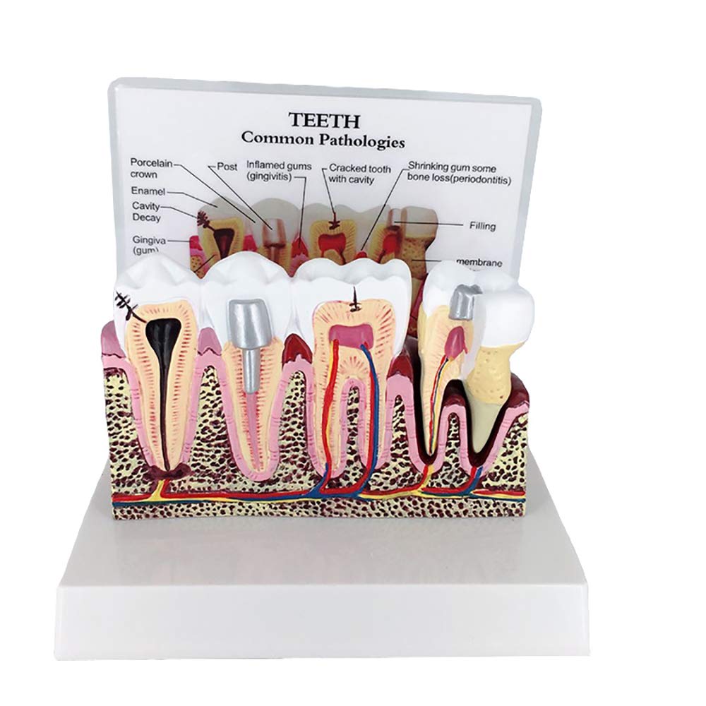 Réplique de l'anatomie du corps humain des dents pour bureau de dentiste
