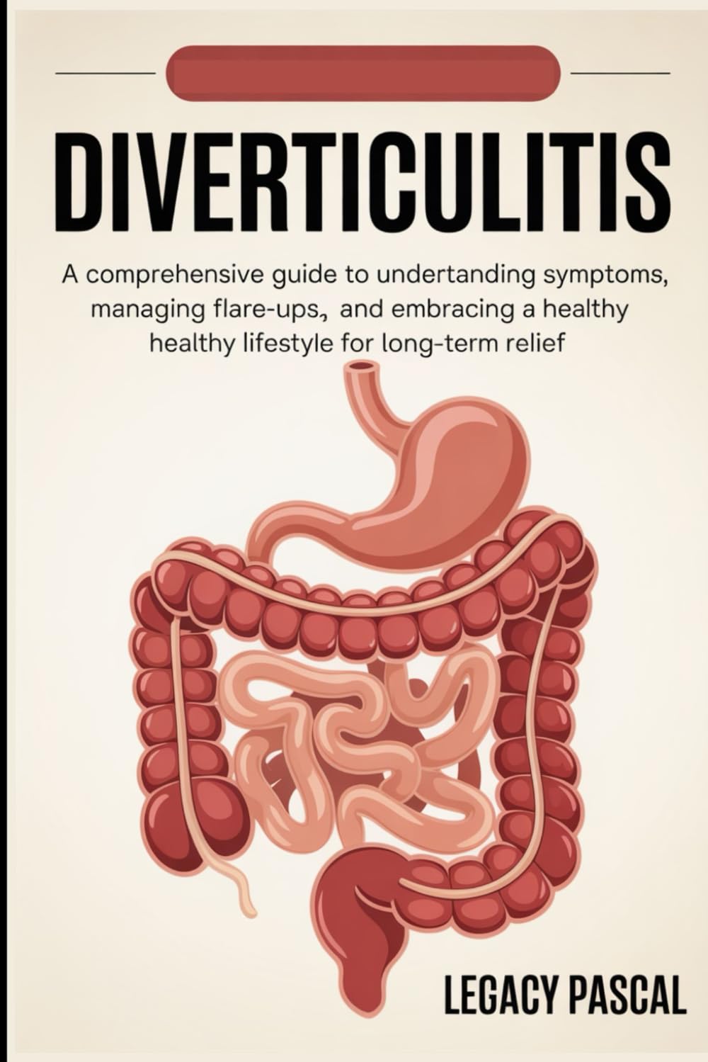 Diverticulitis: A Comprehensive Guide to Understanding Symptoms, Managing Flare-ups, and Embracing a Healthy Lifestyle for Long-term Relief