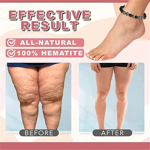 Miniatura 4 de Pulsera magnética de obsidiana negra antihinchazón para desintoxicación de linfa magnética de piedra esmerilada