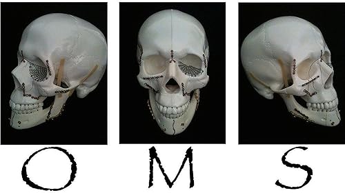 Miniatura 3 de CafePress OMS Surgical Skull Mug 11 oz (325 ml) Ceramic Coffee Mug