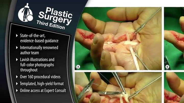Plastic Surgery: Volume 3: Craniofacial, Head and Neck Surgery and