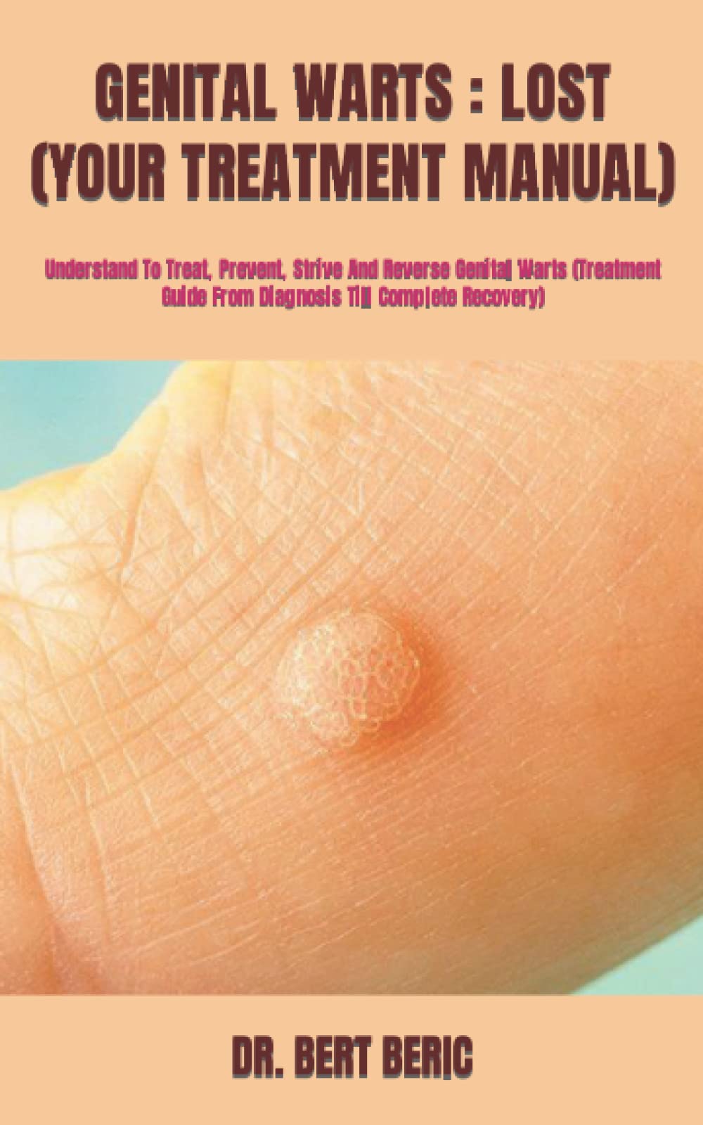 Buy GENITAL WARTS LOST (YOUR MANUAL) Understand To Treat, Prevent