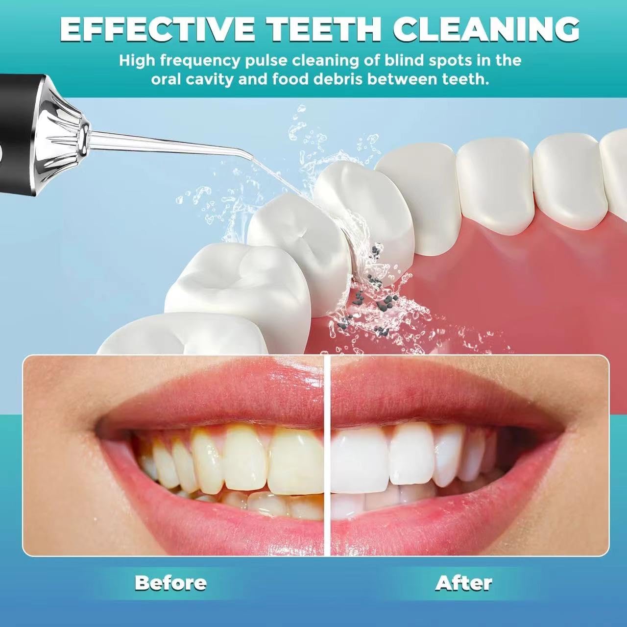 Irrigador dental de agua, portátil, inalámbrico, recargable, limpiador de riego de viaje, 3 modos, 4 chorros, IPX7, impermeable, eléctrico (negro)