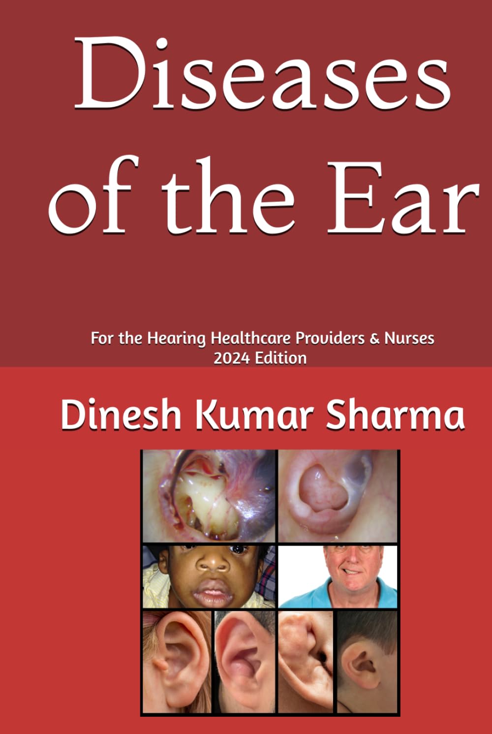 Diseases of the Ear: For the Hearing Healthcare Providers & Nurses