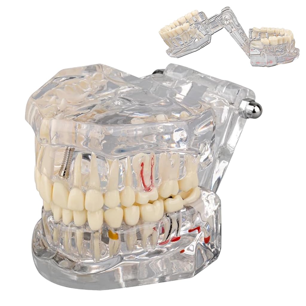 Serplex® Transparent Dental Model 1: 1 Adults Pathological Dental Model with Detachable Teeth Educational Tool for Dentists, Hygienists, Students (B0CQCDV8CZ) Amazon Price History, Amazon Price Tracker