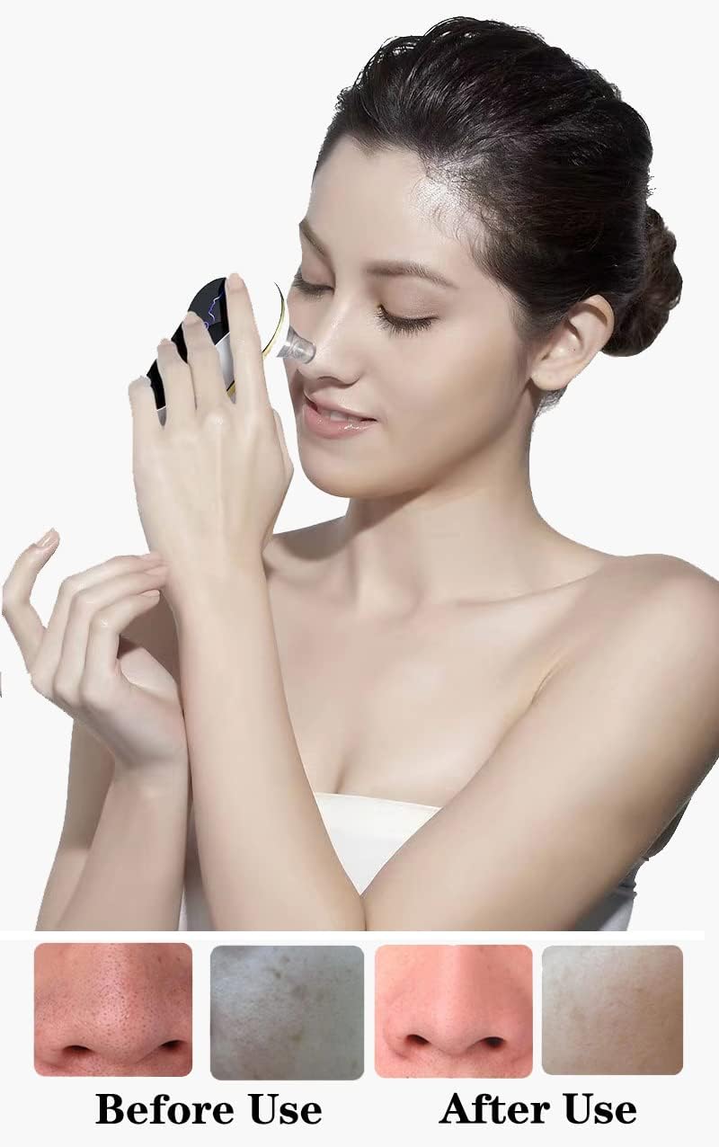Electric Blackhead Instrument, Pore Cleaner Blackhead and Acne Can Remove Stubborn Blackheads and Effectively Shrink Pores (White