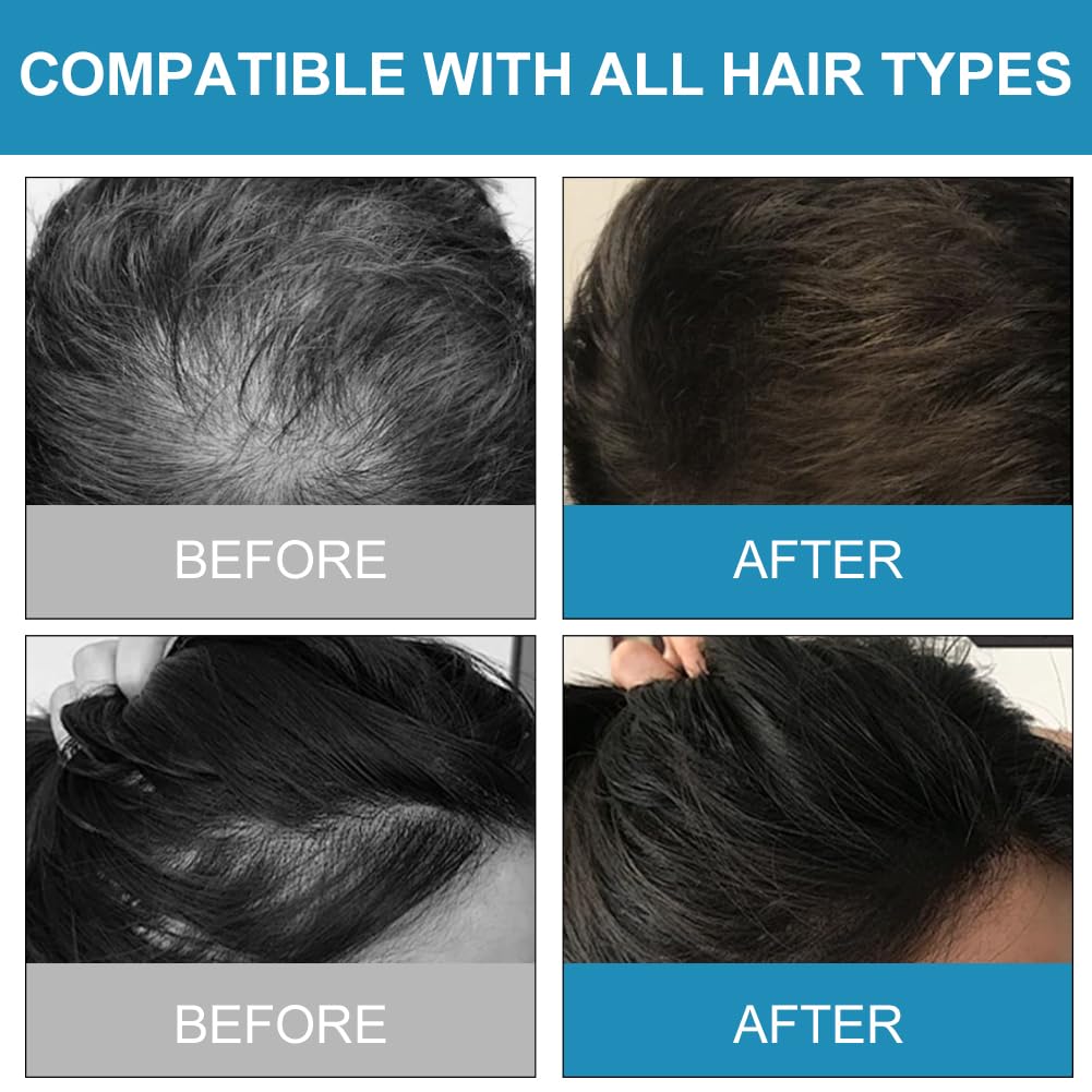 Fibras Capilares, Fibra Correctora Capilar, 27,5g Tratamiento de la Caída Del Cabello para Hombres y Mujeres, Polvo Para Adelgazar el Cabello, Espesante, Cubrir la Calvicie, Cabello Grueso