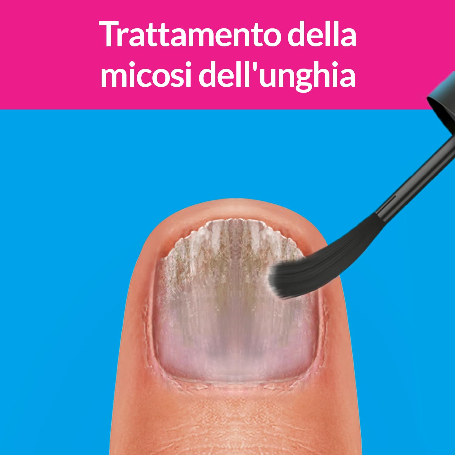 Excilor Micosi dell’unghia Forte, Trattamento della Micosi dell'Unghia Attivo Contro le micosi Persistenti, Confezione da 30 ml