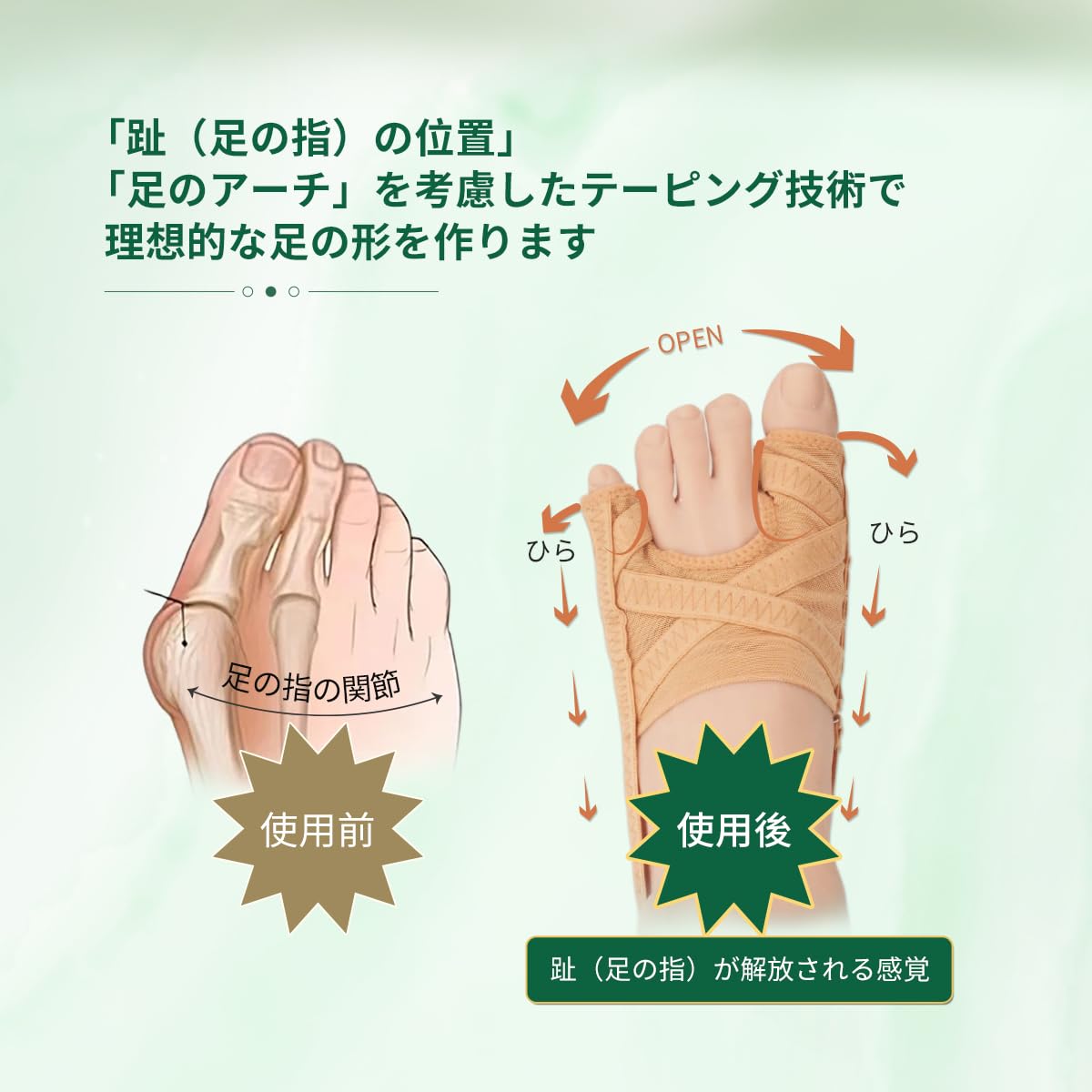 Amazon | Srarosai 足指サポーター 母趾・小趾サポーター 外反母趾対策 
