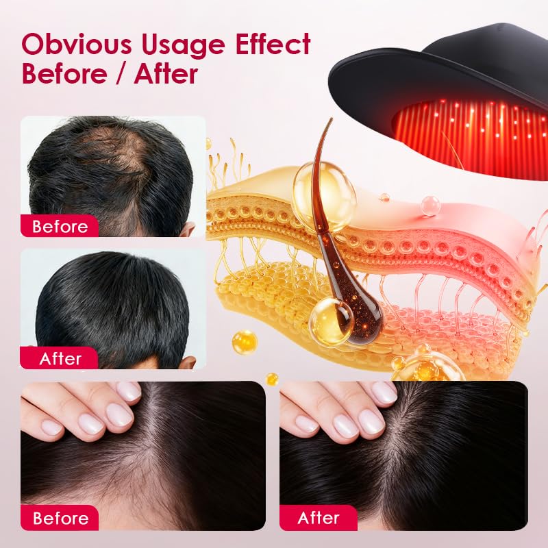 Laser Hair Growth Cap