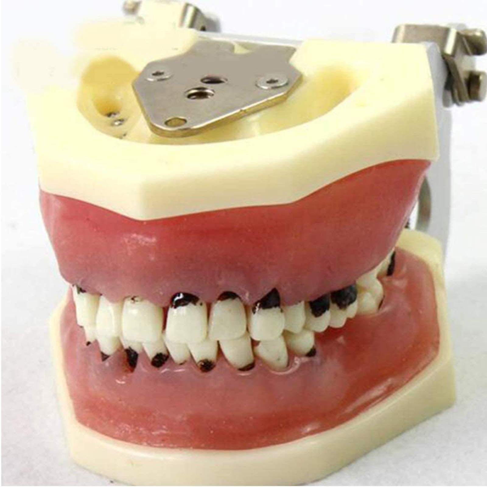 Buy Periodontology Model, Dental Calculus Curettage and Gingival Suture