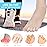 Silicone Toe Protection, 20 Pieces Toe Protection, Toe Tube, for Small Toes and Fingers, Blisters, Calluses, Reduce Rubbing, Relieve Pain.