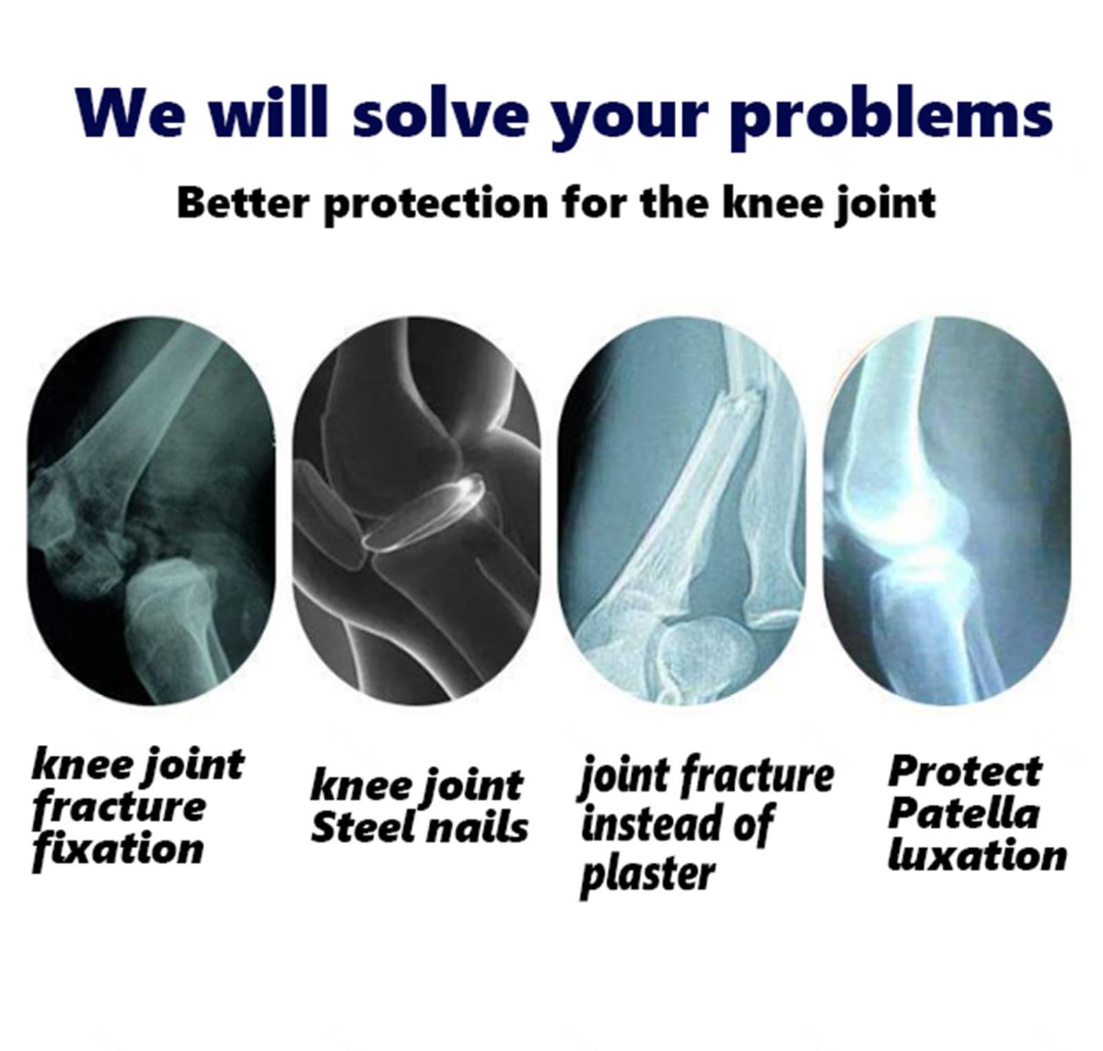 Inmovilizador de Rodillera ROM Postoperatorio Ajustable,Soporte de Rodillera con Bisagras con Correa y Estabilizadores Laterales,para Desgarro de Menisco,Artritis,ACL,PCL,Osteoartritis