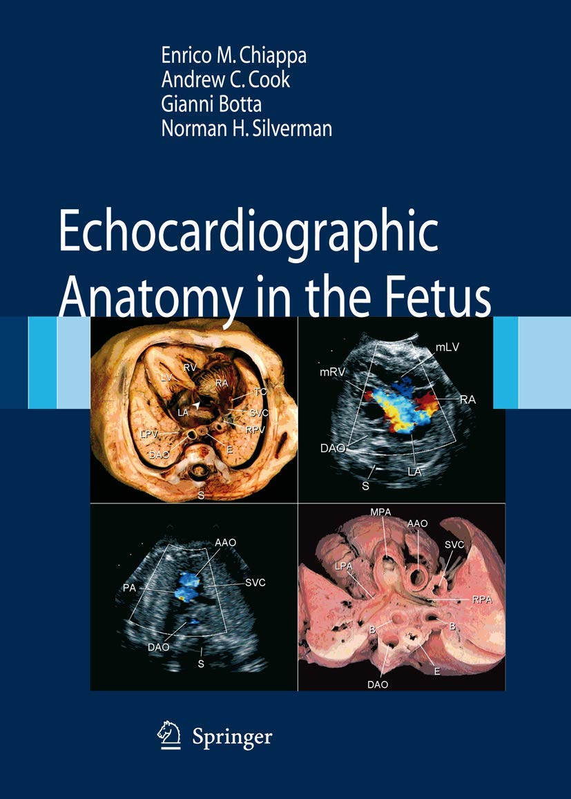 Buy Echocardiographic Anatomy in the Fetus Book Online at Low Prices in  India | Echocardiographic Anatomy in the Fetus Reviews & Ratings - Amazon.in