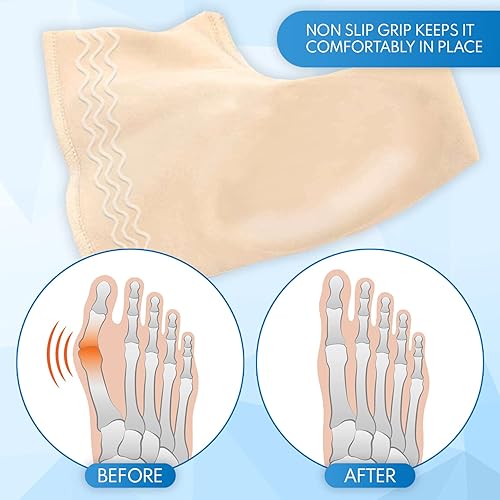 Miniatura 7 de Alayna - Corrector de juanetes y almohadilla de gel para alivio en el dedo gordo del pie soporte acolchado para alivio del dolor del dedo en