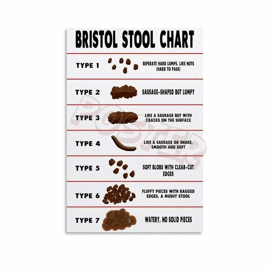 amazon-com-rrtefd-bristol-stool-chart-diagnosis-constipation-diarrhea-chart-knowledge-poster-7-canvas-painting-posters-and-prints-wall-art-for-living-room-bedroom-decor-20x30inch-50x75cm-unframe-style-posters-prints for Free Printable Bristol Stool Chart Amazon.com: RRTEFD Bristol Stool Chart Diagnosis Constipation Diarrhea Chart Knowledge Poster (7) Canvas Painting Posters And Prints Wall Art for Living Room Bedroom Decor 20x30inch(50x75cm) Unframe-style: Posters & Prints for Free Printable Bristol Stool Chart