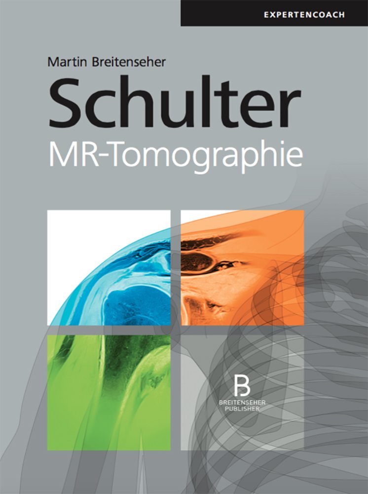 Schulter MR-Tomographie