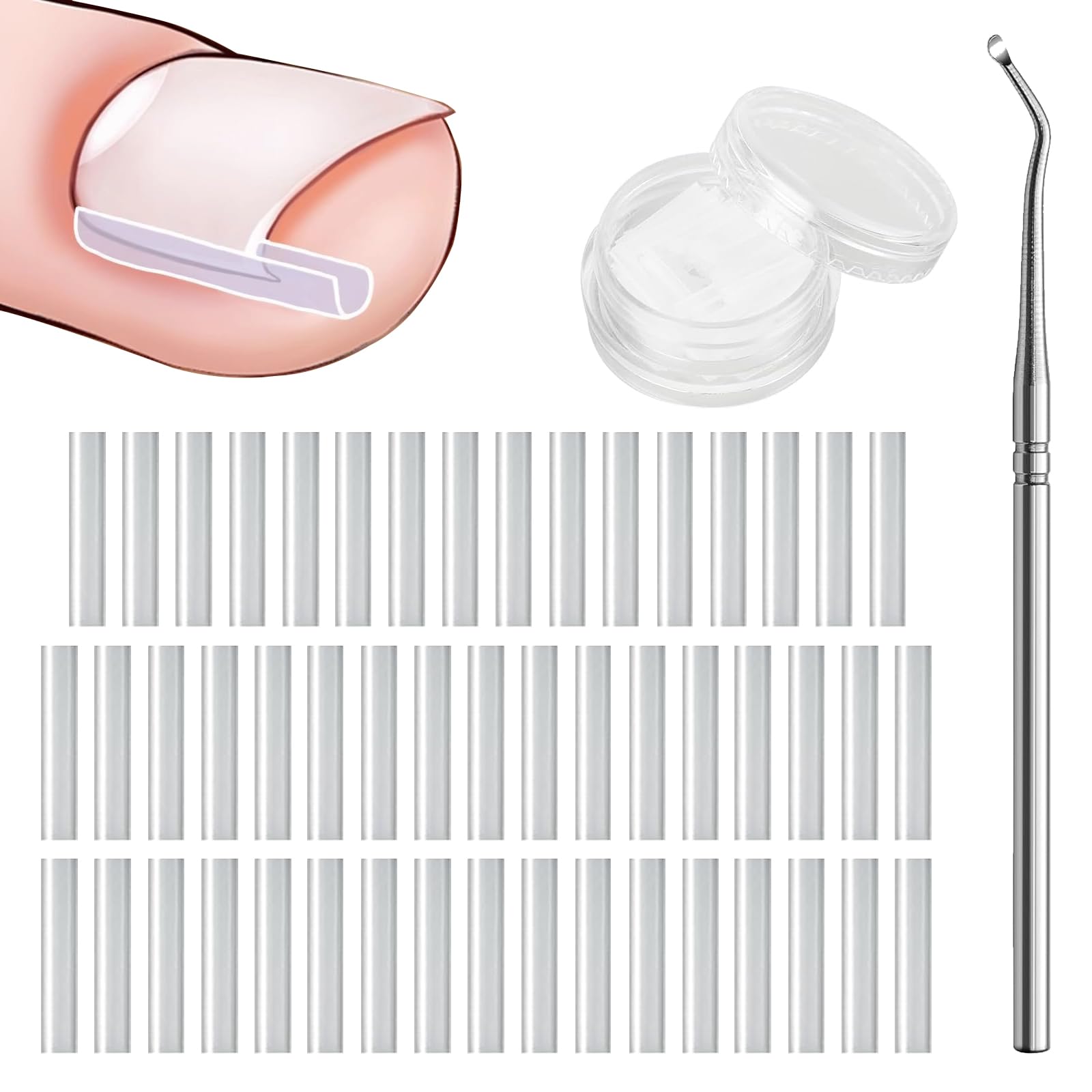 Ensemble Correcteur d'Ongles Incarnés - 50 Bandes Sans Douleur pour Redresser les Ongles avec Élévateur d'Ongles - Kit Facile à Utiliser d'Outils pour Ongles Incarnés