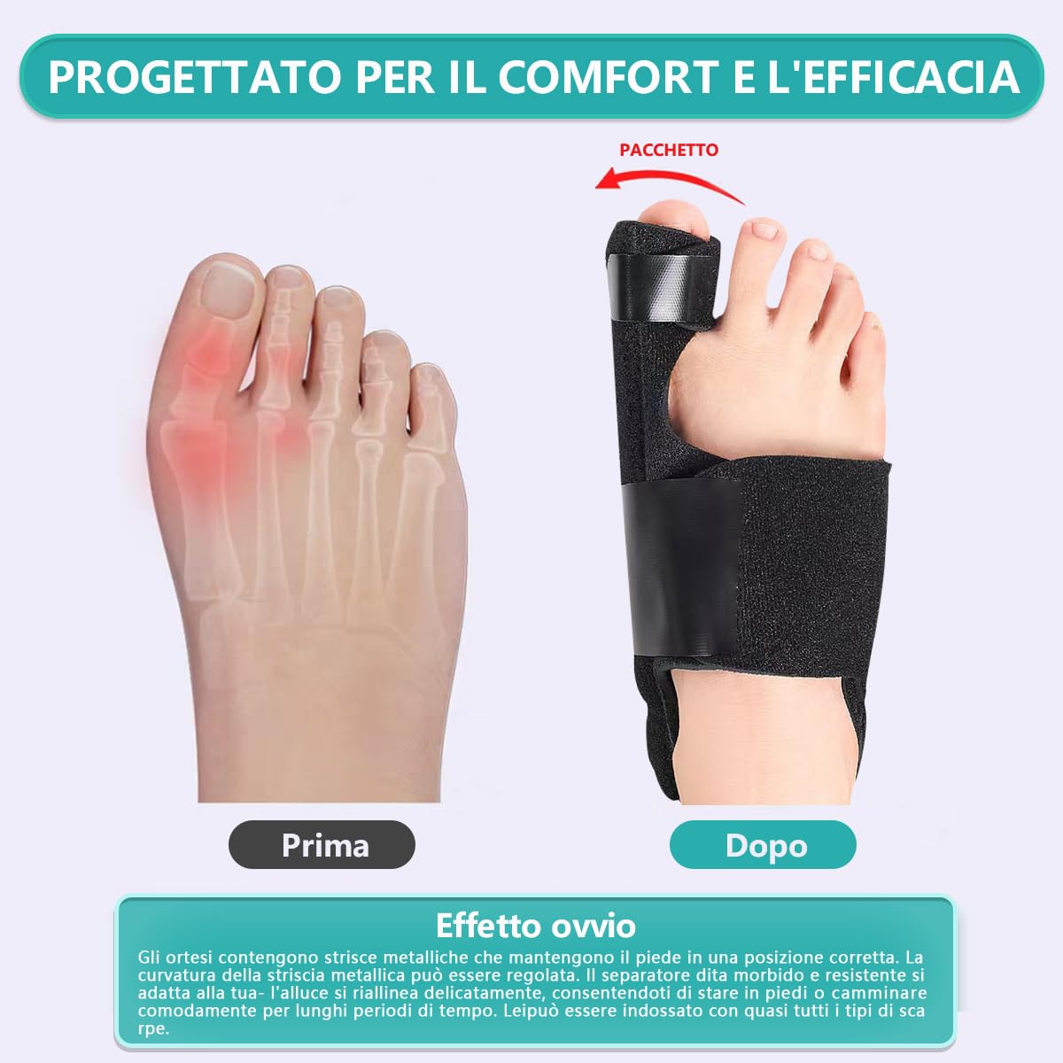 Wuiil 2 Stecche Correttive,2 Separatori per Dita,Alluce Valgo Correttore Separadita,Tutore Alluce Valgo,Distanziatore Alluce Valgo in Silicone,Donna E Uomo Proteggi Dita Piedi,Sollievo Dal Dolore