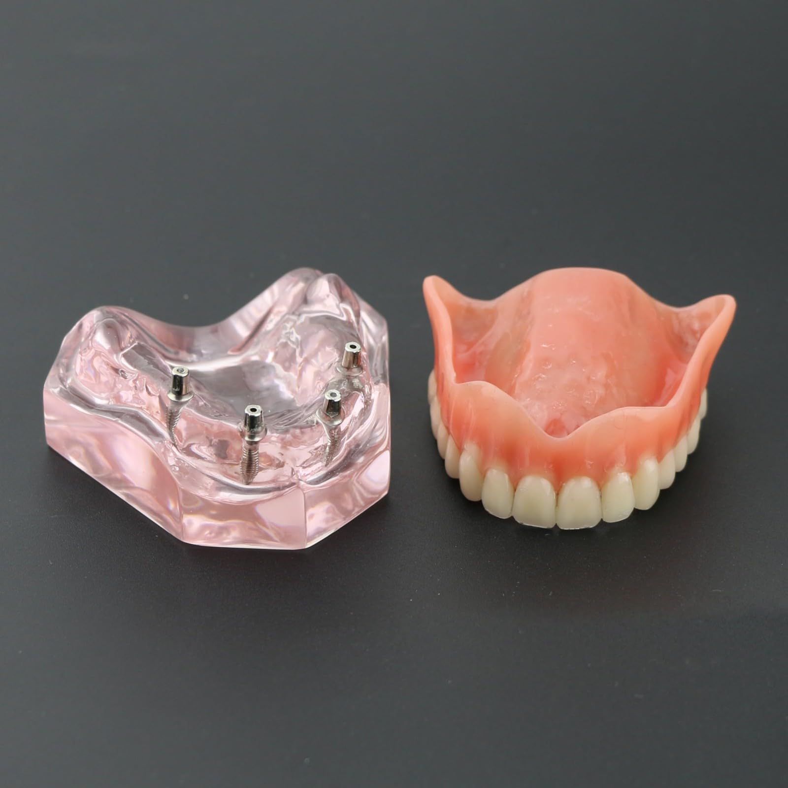 Modelo de dientes para implantes dentales tipodonto, rosa transparente, restauración de implantes dentales tipodonto, sobredentadura, 4 implantes, superior, demostración para estudio y enseñanza.