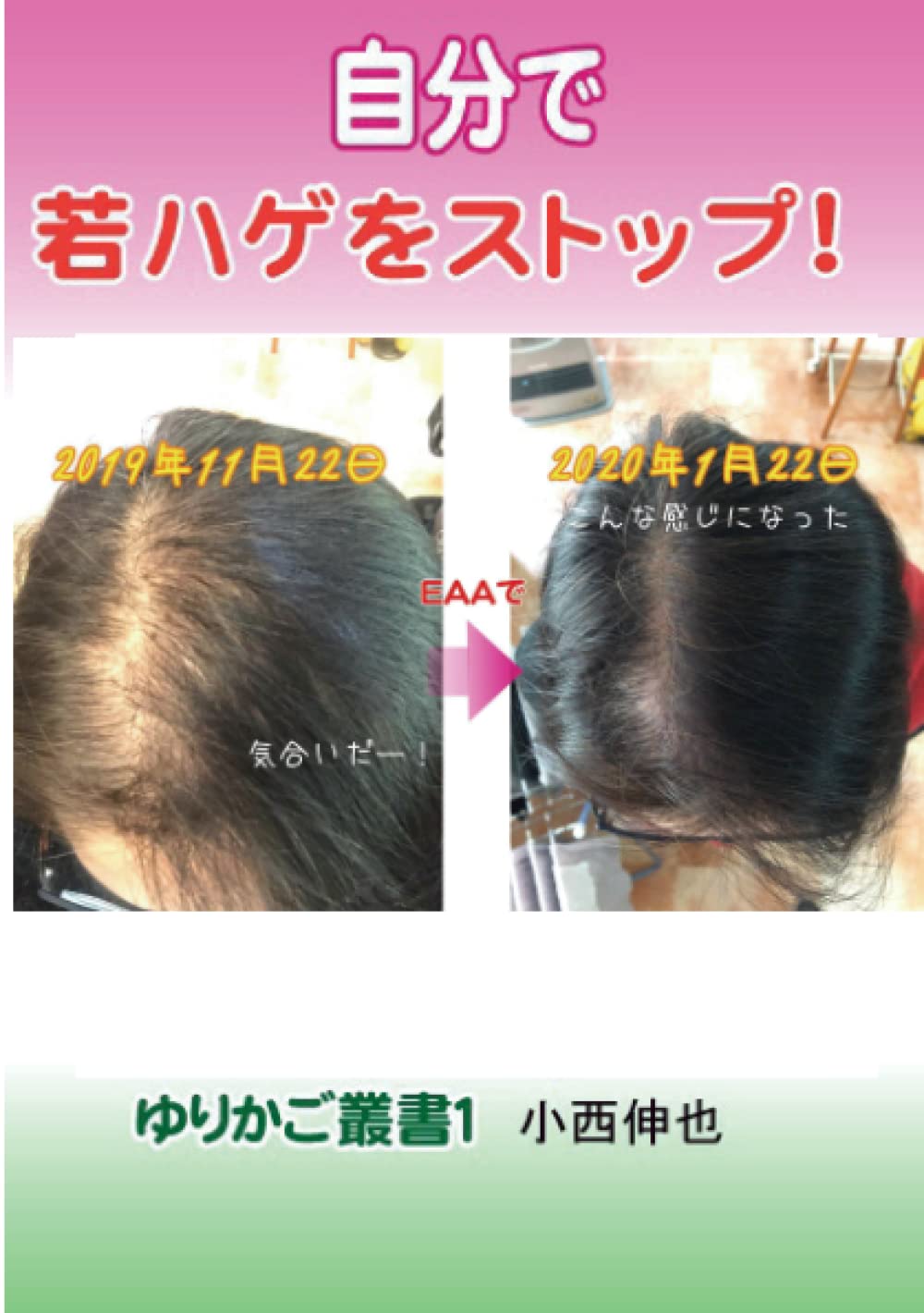 自分で若ハゲをストップ 小西伸也 本 通販 Amazon