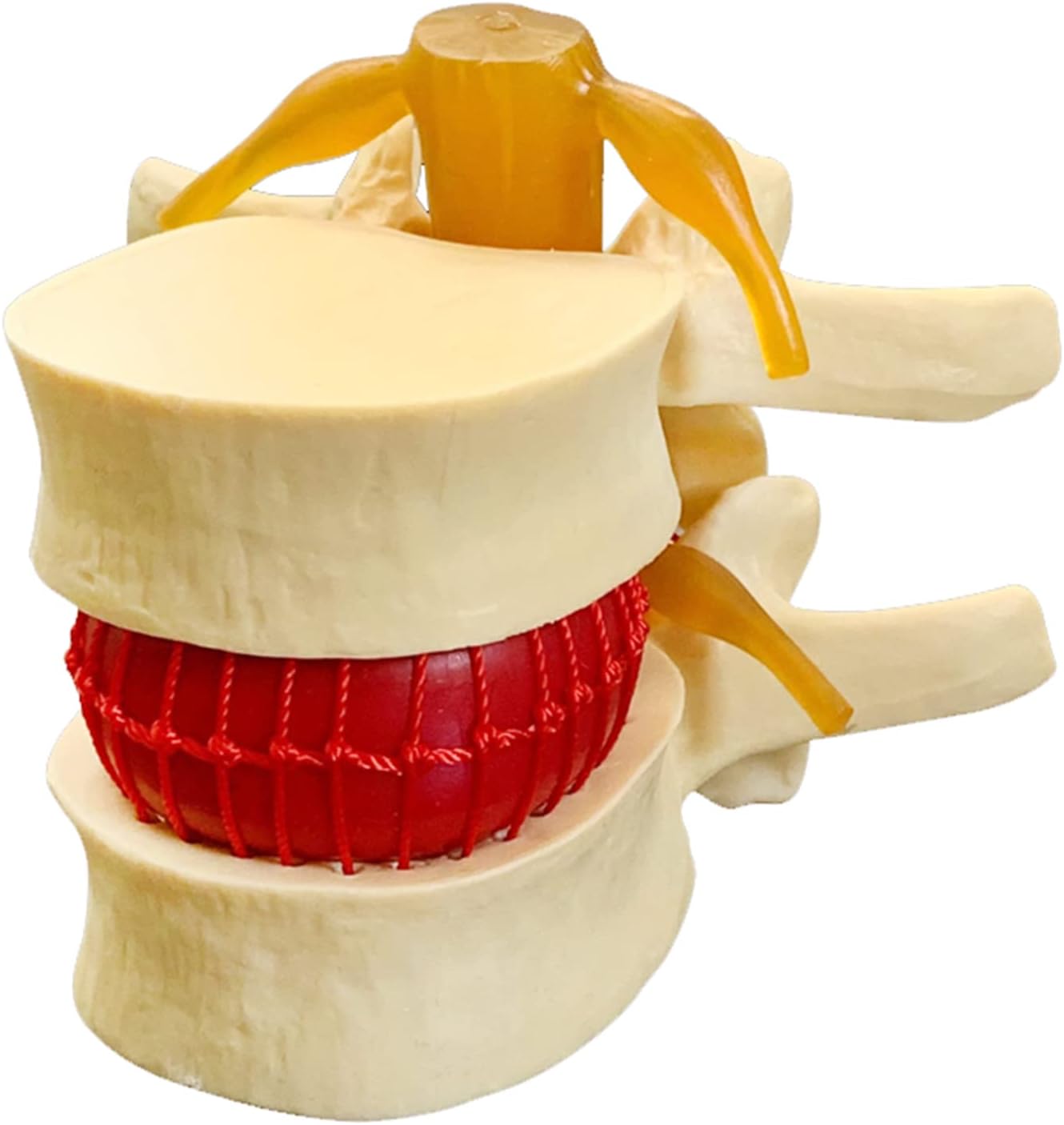 KH66ZKY Lumbar Human Spine Model Human Anatomical Lumbar Disc Herniation Model