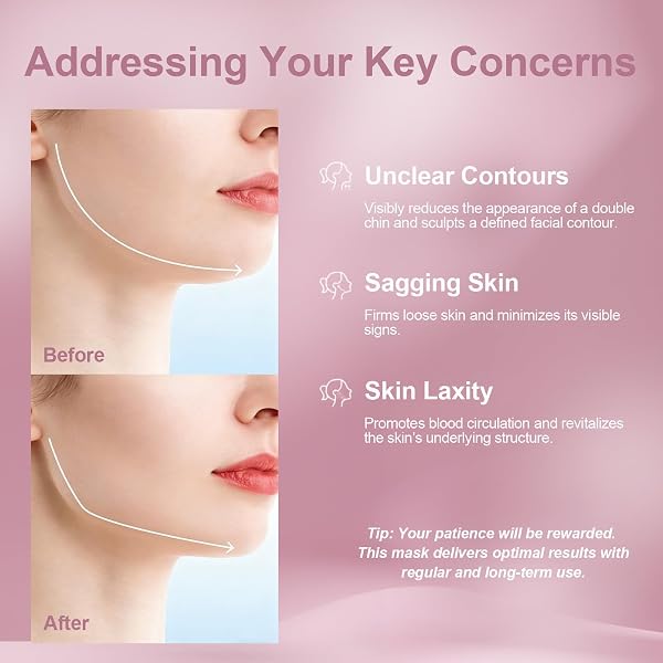 2PCS Masque Double Menton Amincissant, Bandeau Raffermissante Réutilisable aux Tissu Respirant Réglable, Bandeau Liftant Visage pour Femmes, Masque Facial en Forme de V pour Réduit le Double Menton - 2