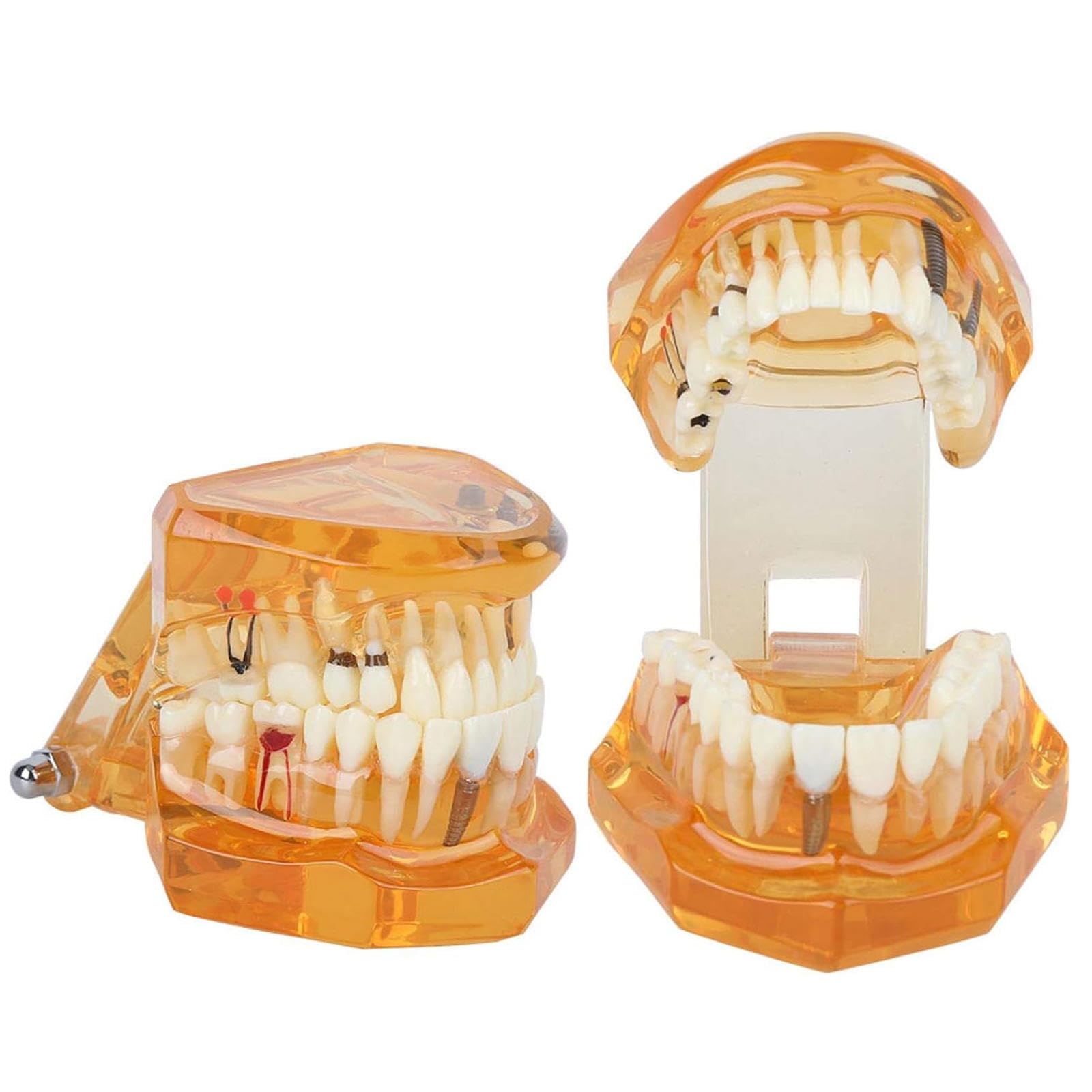 Modello di Insegnamento dello Studio Rimovibile di Malattie Dentali, Modello per Programmi Scolastici di Odontoiatria, Modello di Impianto Dentale, Strumento Dimostrativo