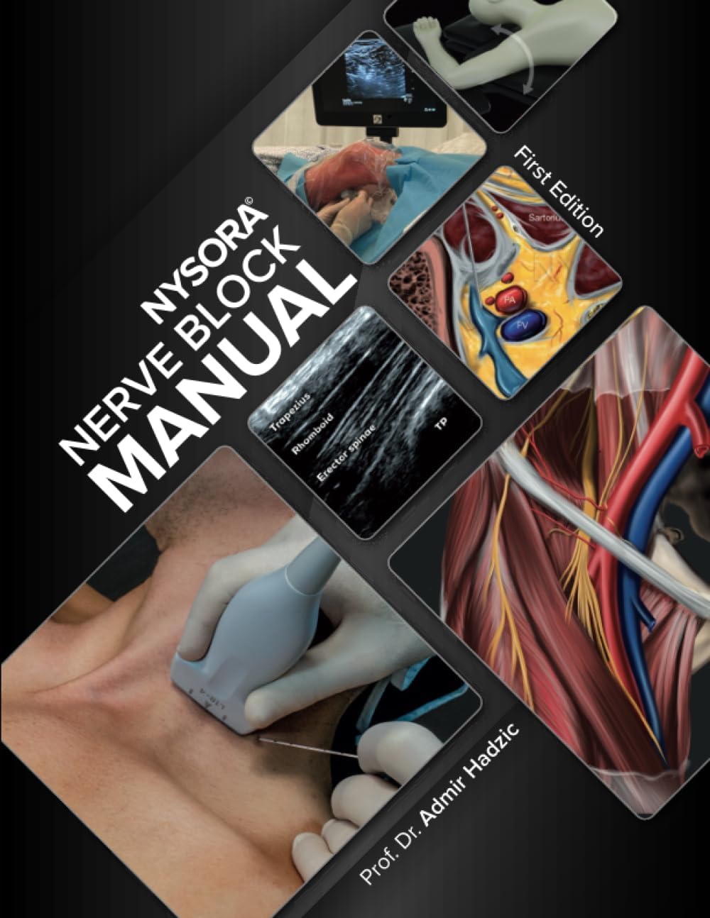 NYSORA Nerve Block Manual: First Edition (Regional Anesthesia)