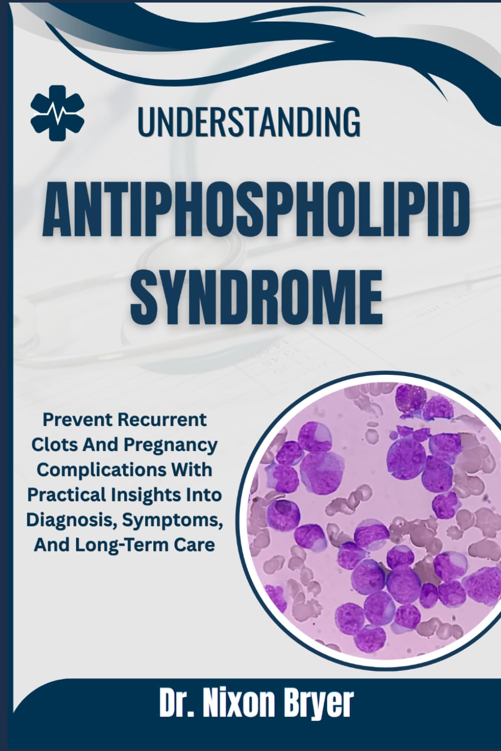 Understanding Antiphospholipid Syndrome: Prevent Recurrent Clots And Pregnancy Complications With Practical Insights Into Diagnosis, Symptoms, And Long-Term Care