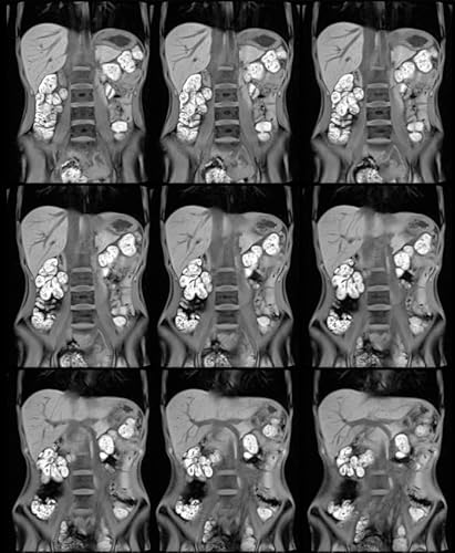Episode 41 Body MRI Update