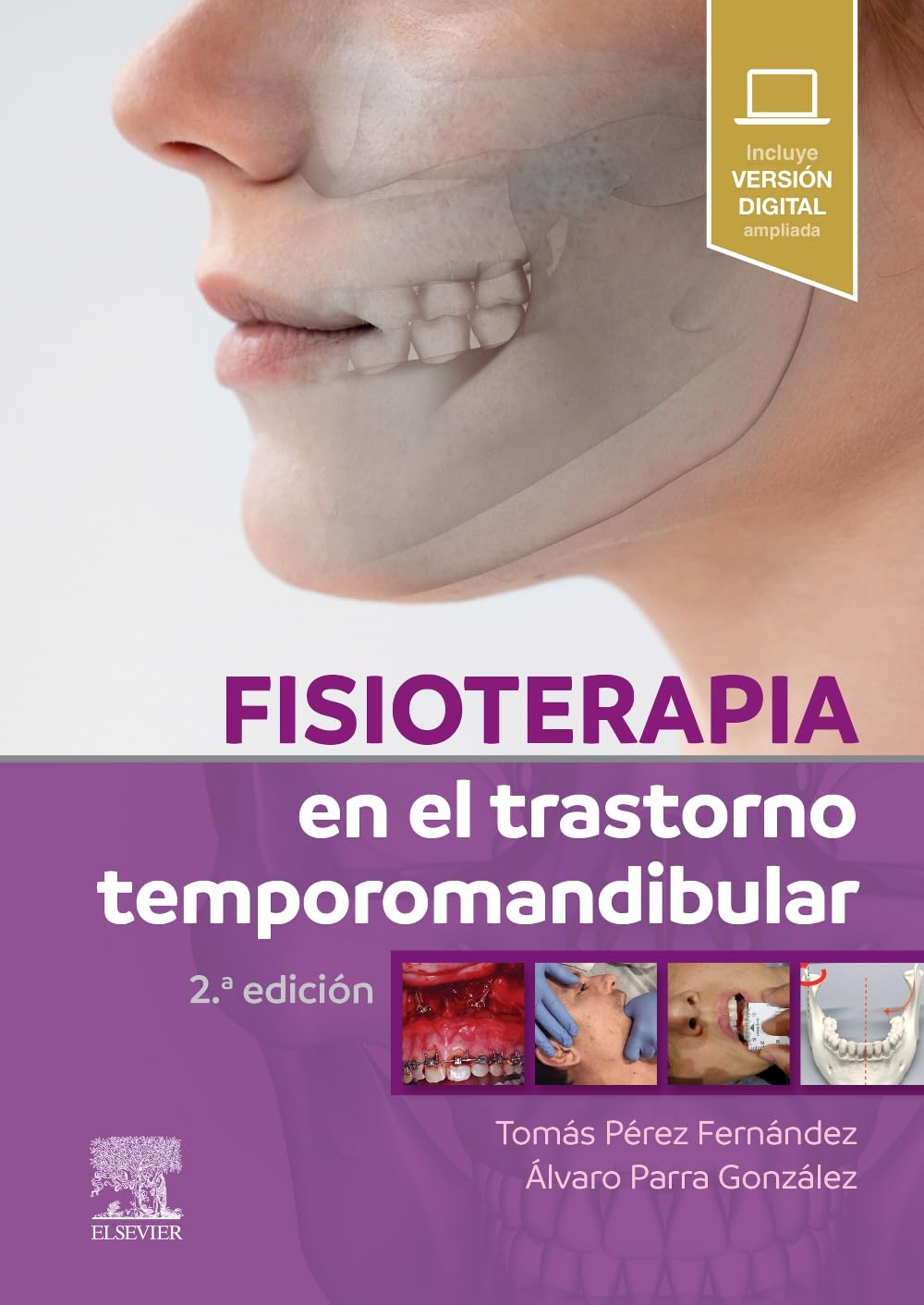 Fisioterapia en el trastorno temporomandibular (2ª ed.)