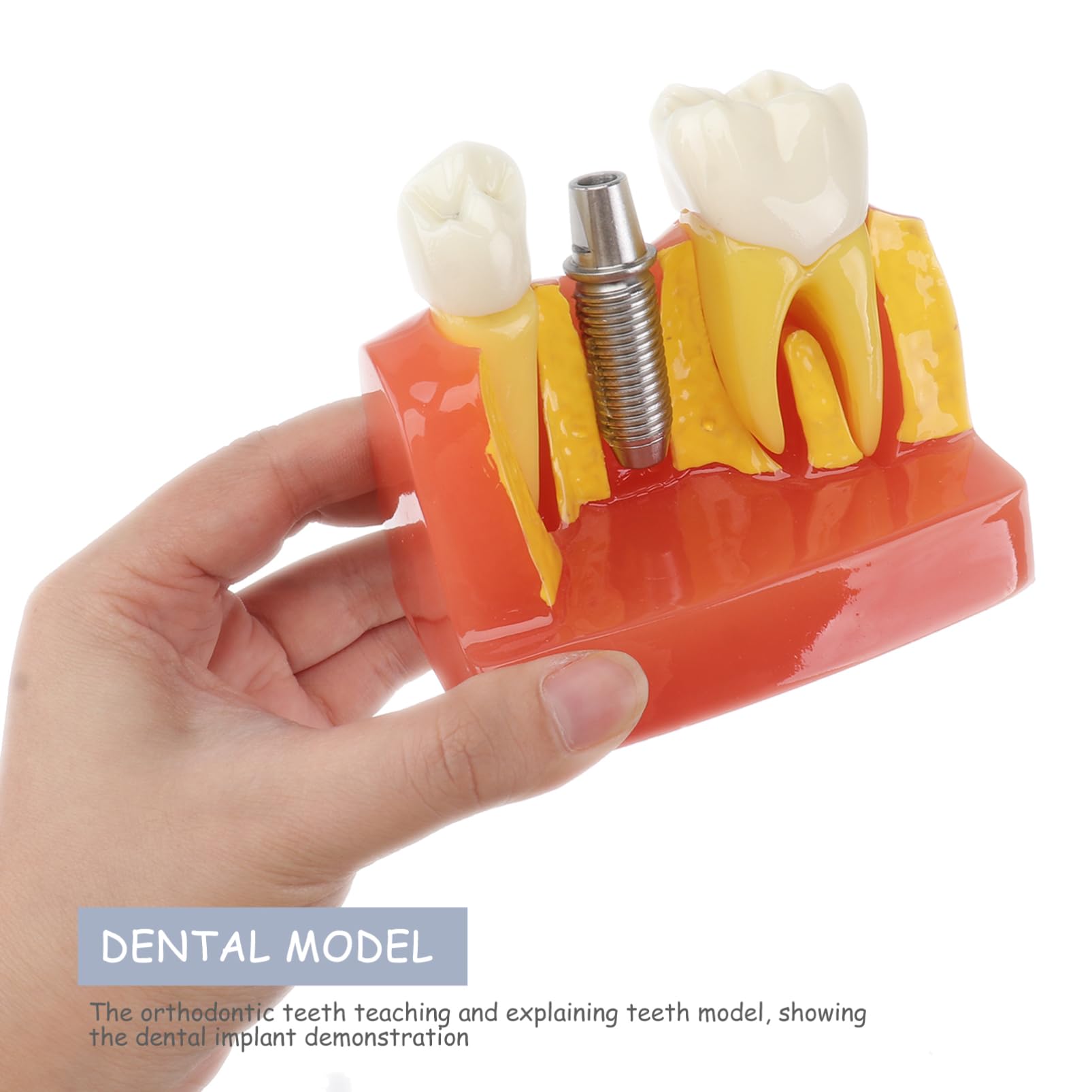 OUNONA 1pezzi Modello di Denti Didattico Rimovibile per Strumento Educativo per Lezioni di Odontoiatria Modello di Studio con Denti e Protesi