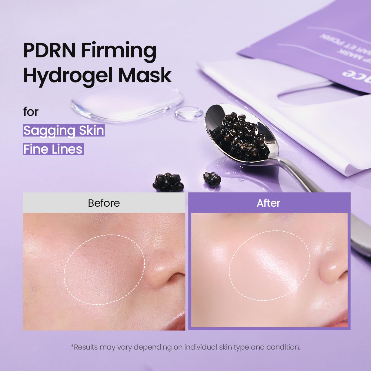BIODANCE Rejuvenating Caviar PDRN Real Deep Mask, Overnight Hydrogel Mask, Firming, Radiance, Enhancing Skin Recovery, Korean Skin Care, Valentines Day | 1.19oz(34g) x 4ea - 4