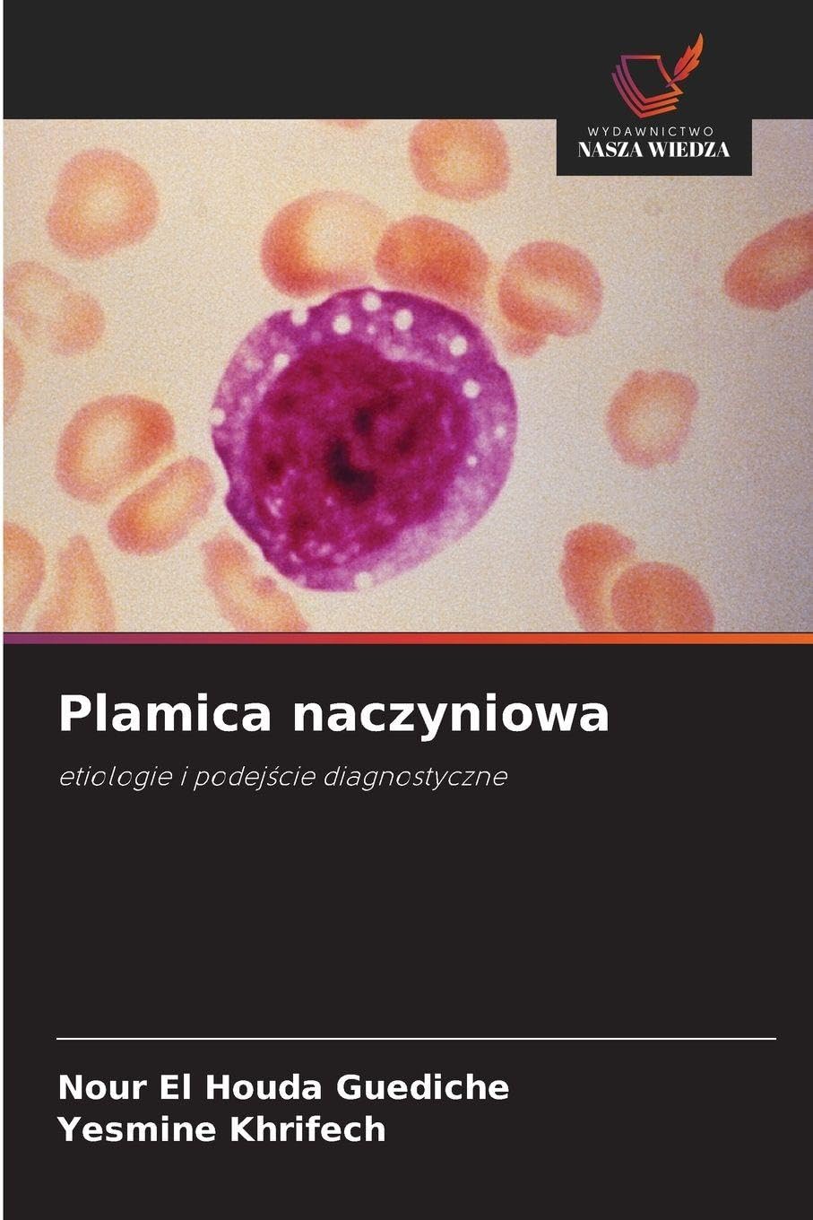 Plamica naczyniowa: etiologie i podej¿cie diagnostyczne